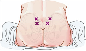 Copyright of Michael Norviel